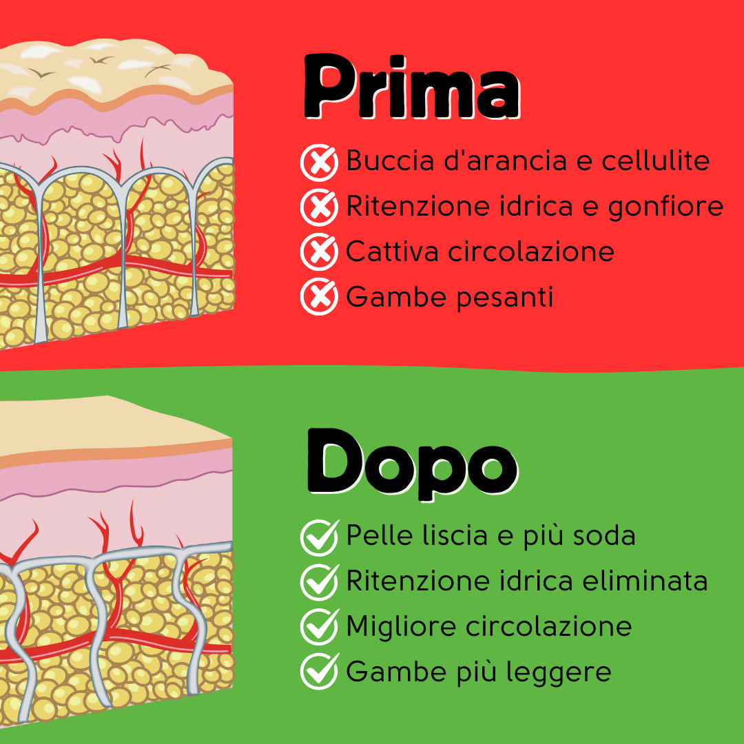 cellulite avant et après 